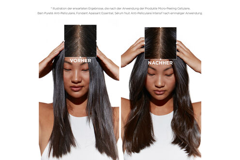 Symbiose Bain Purete Anti-Pelliculaire - Symbiose | L'Oréal Partner Shop