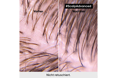 Scalp Advanced Anti-Oiliness 2in1 Deep Purifier Clay - Scalp Advanced | L'Oréal Partner Shop