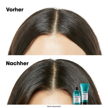 Anti-Discomfort Dermo-Regulator Shampoo Refill - Scalp Advanced | L'Oréal Partner Shop