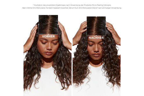 Symbiose Bain Creme Anti-Pelliculaire - Symbiose | L'Oréal Partner Shop